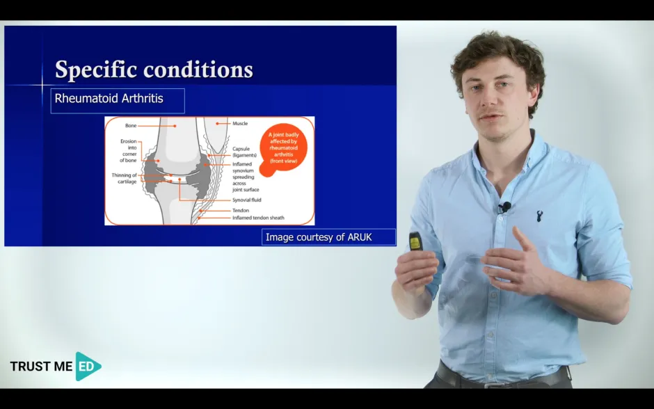 Rheumatology in Physiotherapy.