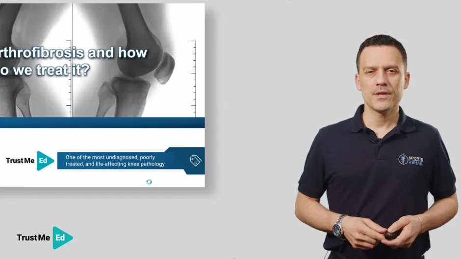 Management of Knee Arthrofibrosis