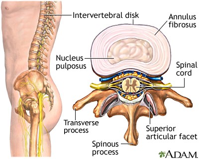 disc-3