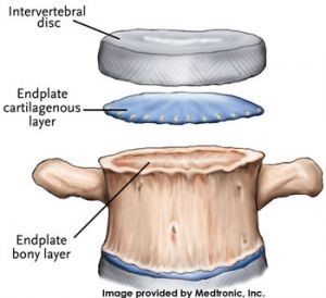 disc2
