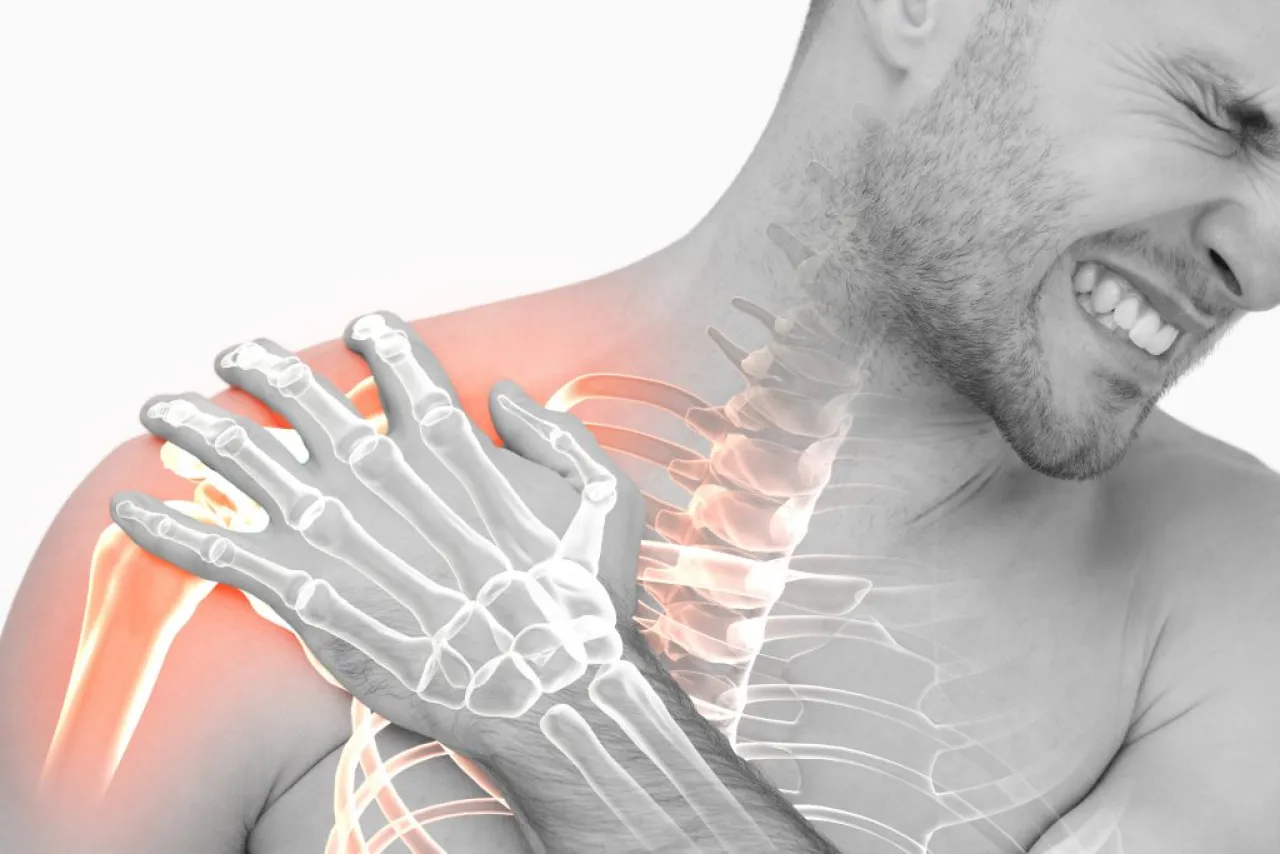 Impinging on the impingement theory