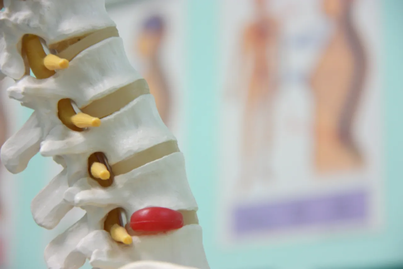 Back Pain Myths: Posture, Core Strength, Bulging Discs