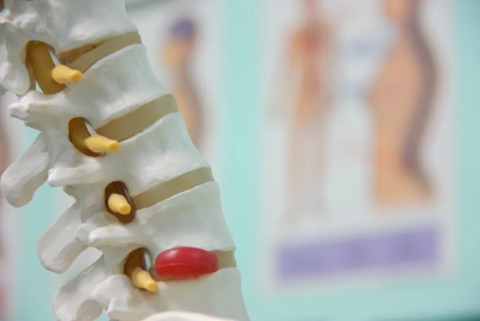 Back Pain Myths: Posture, Core Strength, Bulging Discs
