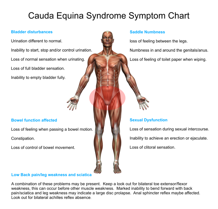 symptoms-chart-cauda-equina