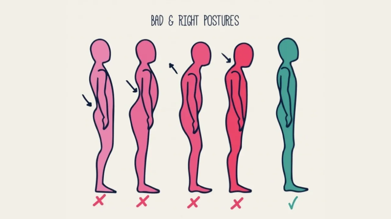 THE SCIENCE BEHIND WHY ASSESSING AND BLAMING POSTURE FOR PAIN IS BS