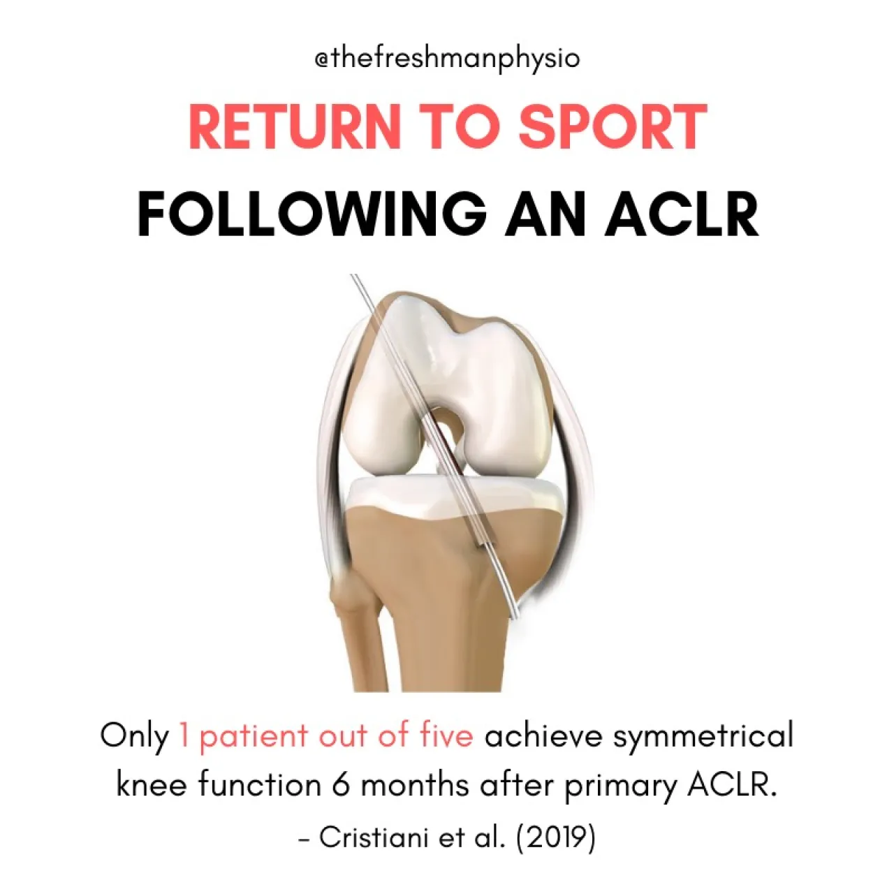 Return to sport following an ACLR