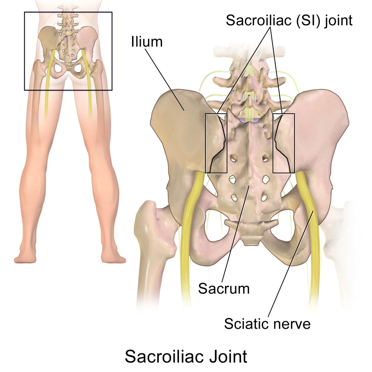 Detecting movement in the SI-Joint