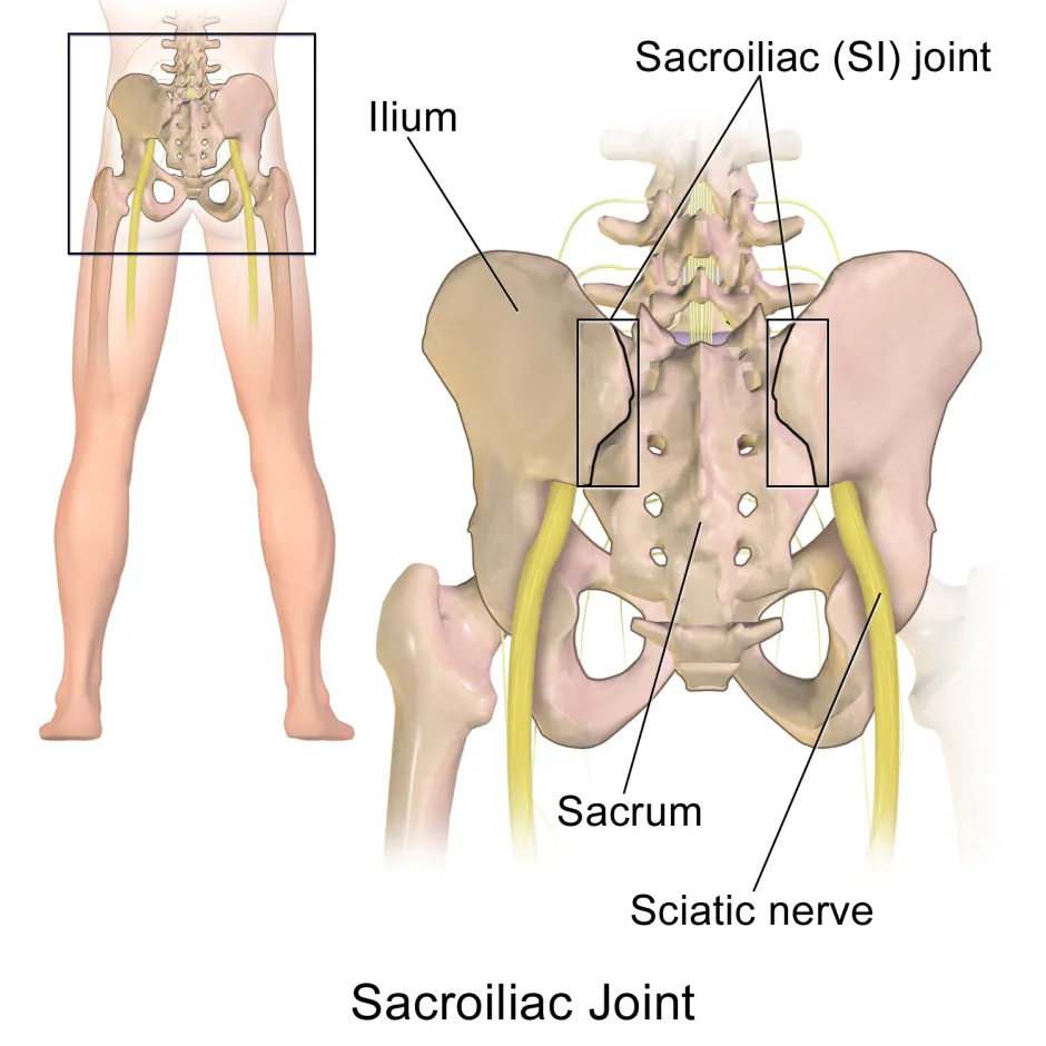 Detecting movement in the SI-Joint