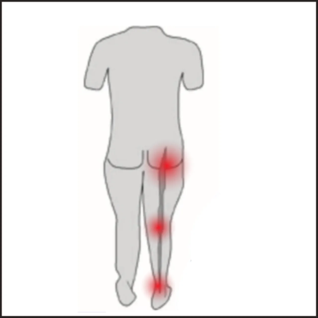 4 WAYS TO SELF MANAGE LUMBAR SPINAL STENOSIS