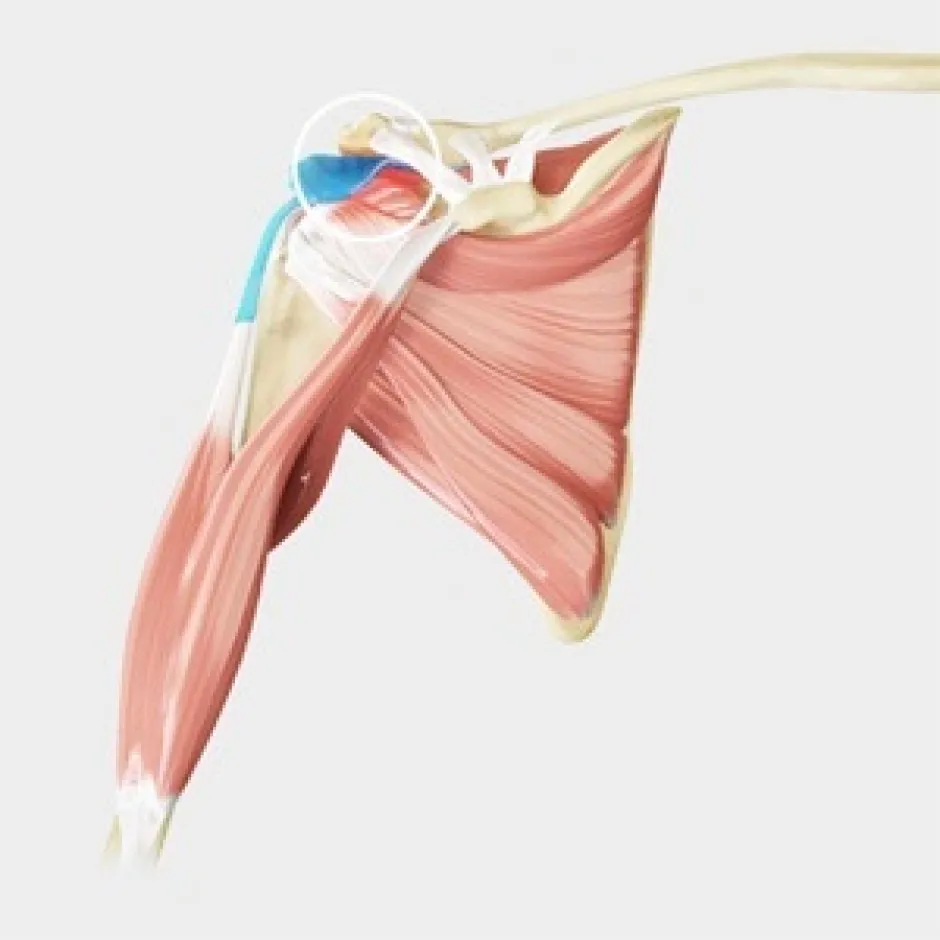 5 REASONS WHY IT MAY BE TIME TO STOP USING THE TERM “IMPINGEMENT”