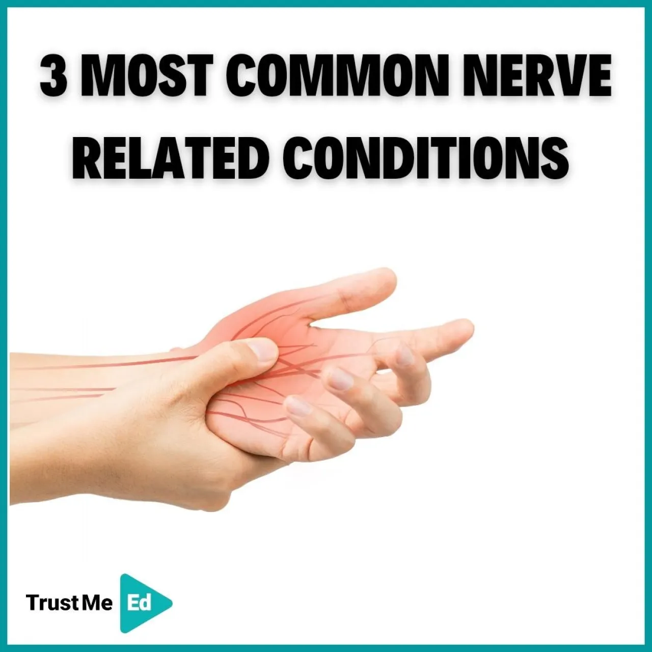 3 MOST COMMON NERVE RELATED CONDITIONS
