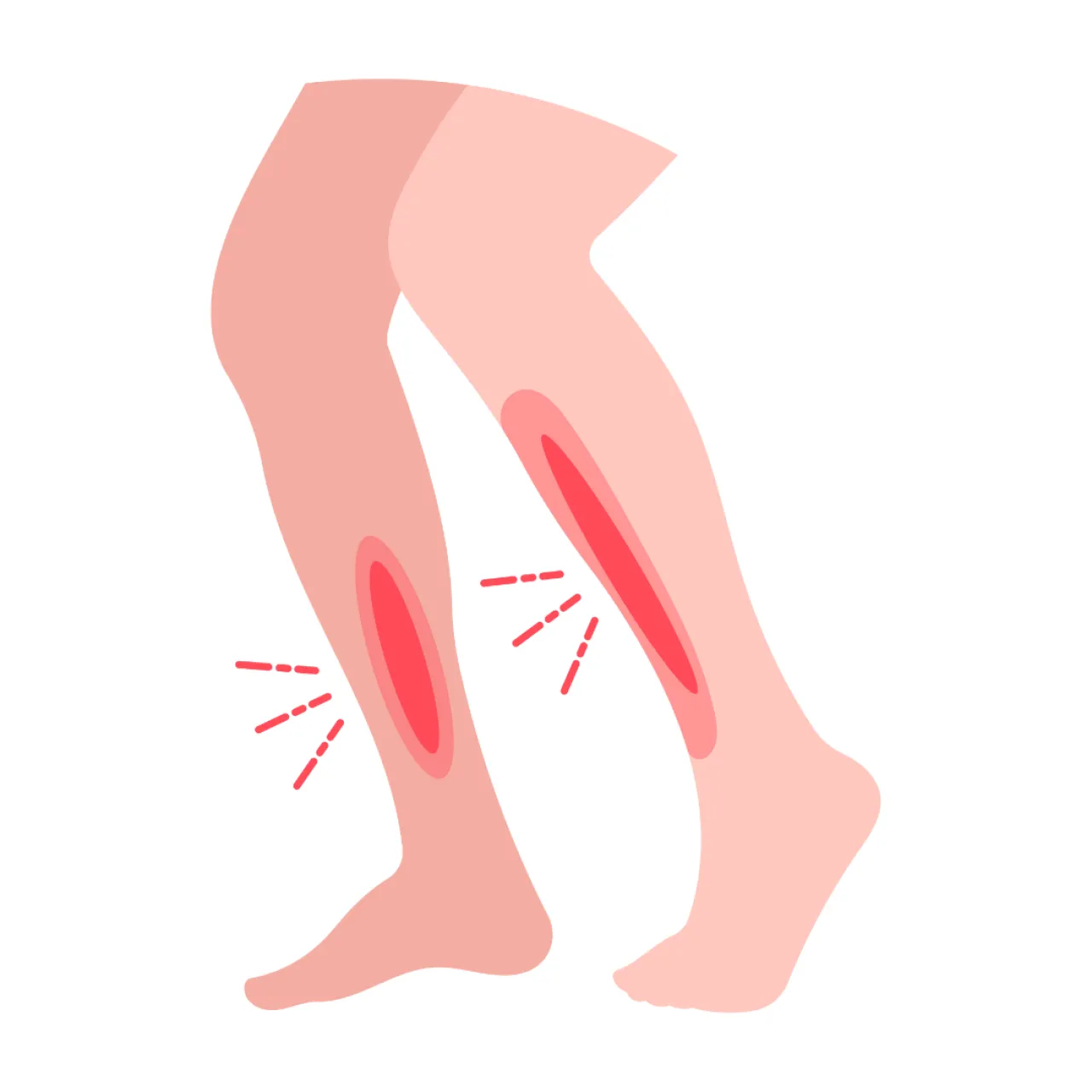 5 THINGS TO REMEMBER WHEN TREATING BONE STRESS INJURIES