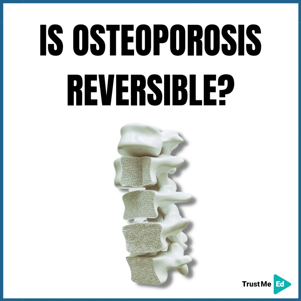 IS OSTEOPOROSIS REVERSIBLE?