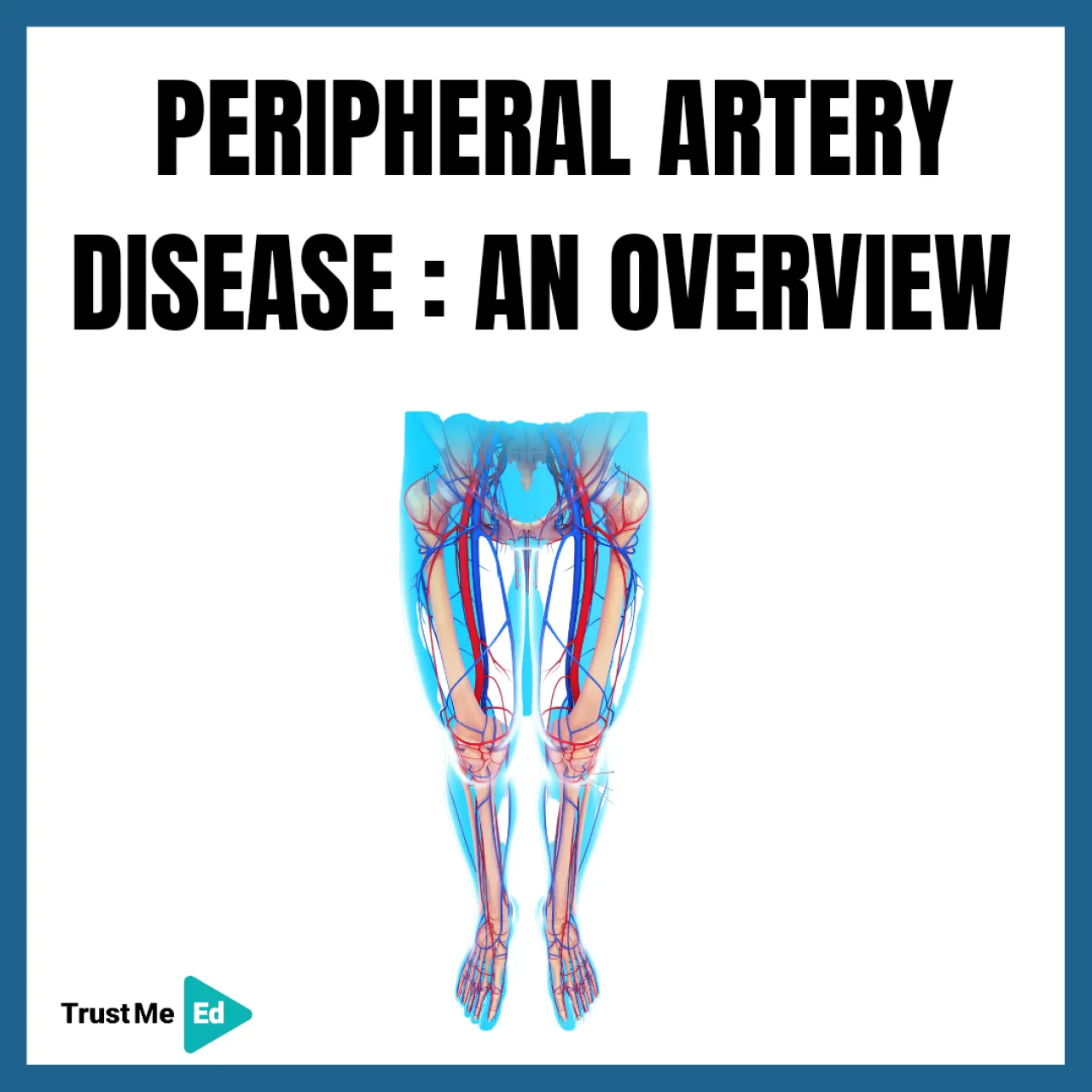 PERIPHERAL ARTERY DISEASE - AN OVERVIEW