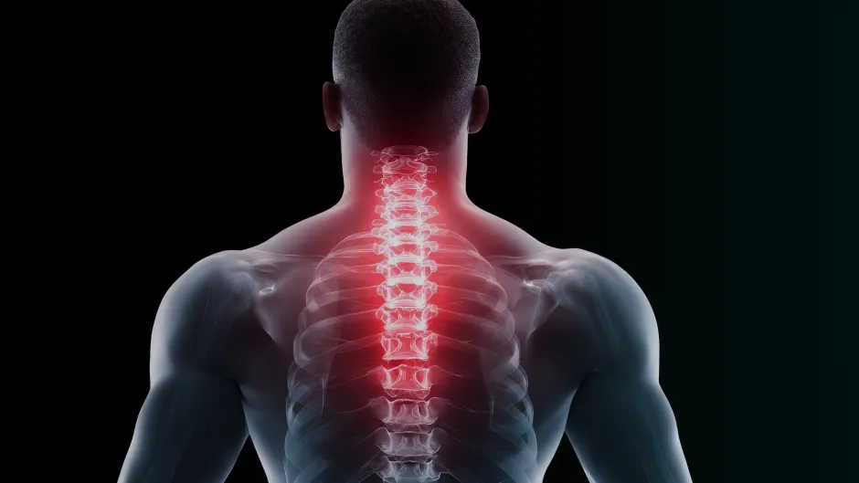 Understanding Degenerative Cervical Myelopathy