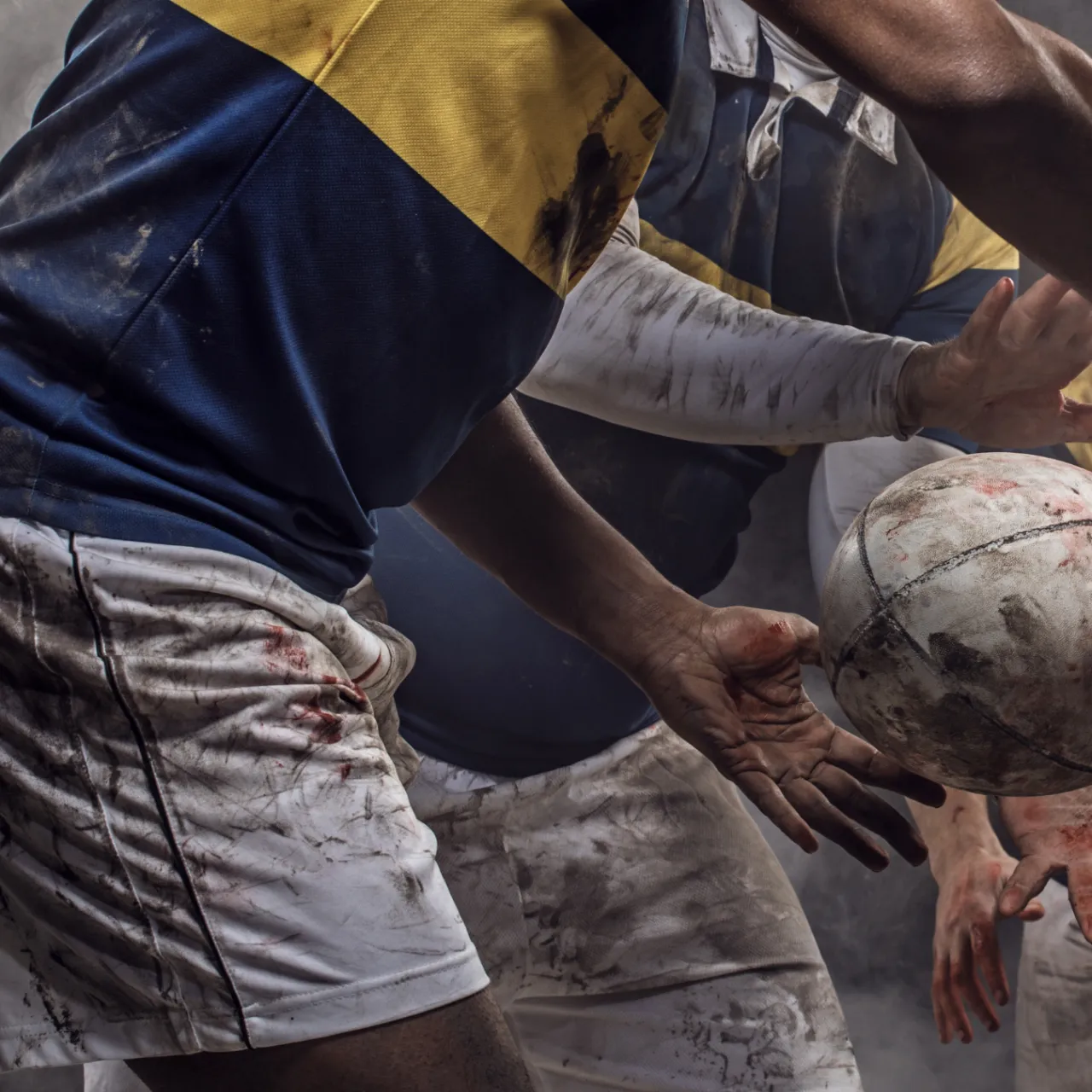 Concussion: What should you look out for?